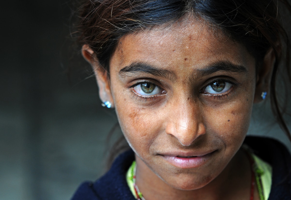 Young Girl's Sharp Eyes Lead to Rescue of Critically Endangered Axolotl in Wales