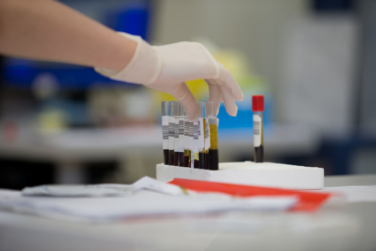 Researchers Develop Blood Test That Could Identify Depression Early