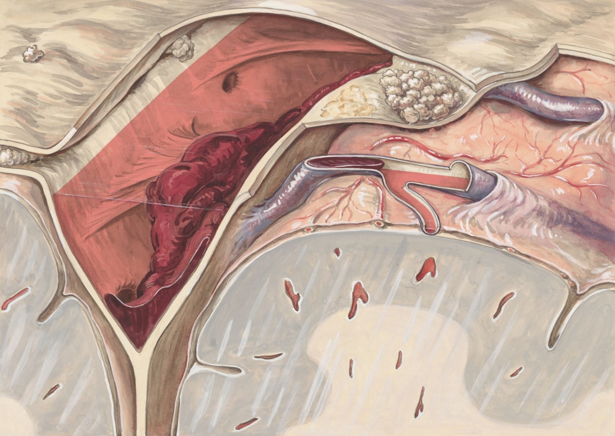 Breakthrough AI Tool Spots Pancreatic Cancer Years Earlier, Opening Door to Life-Saving Treatment