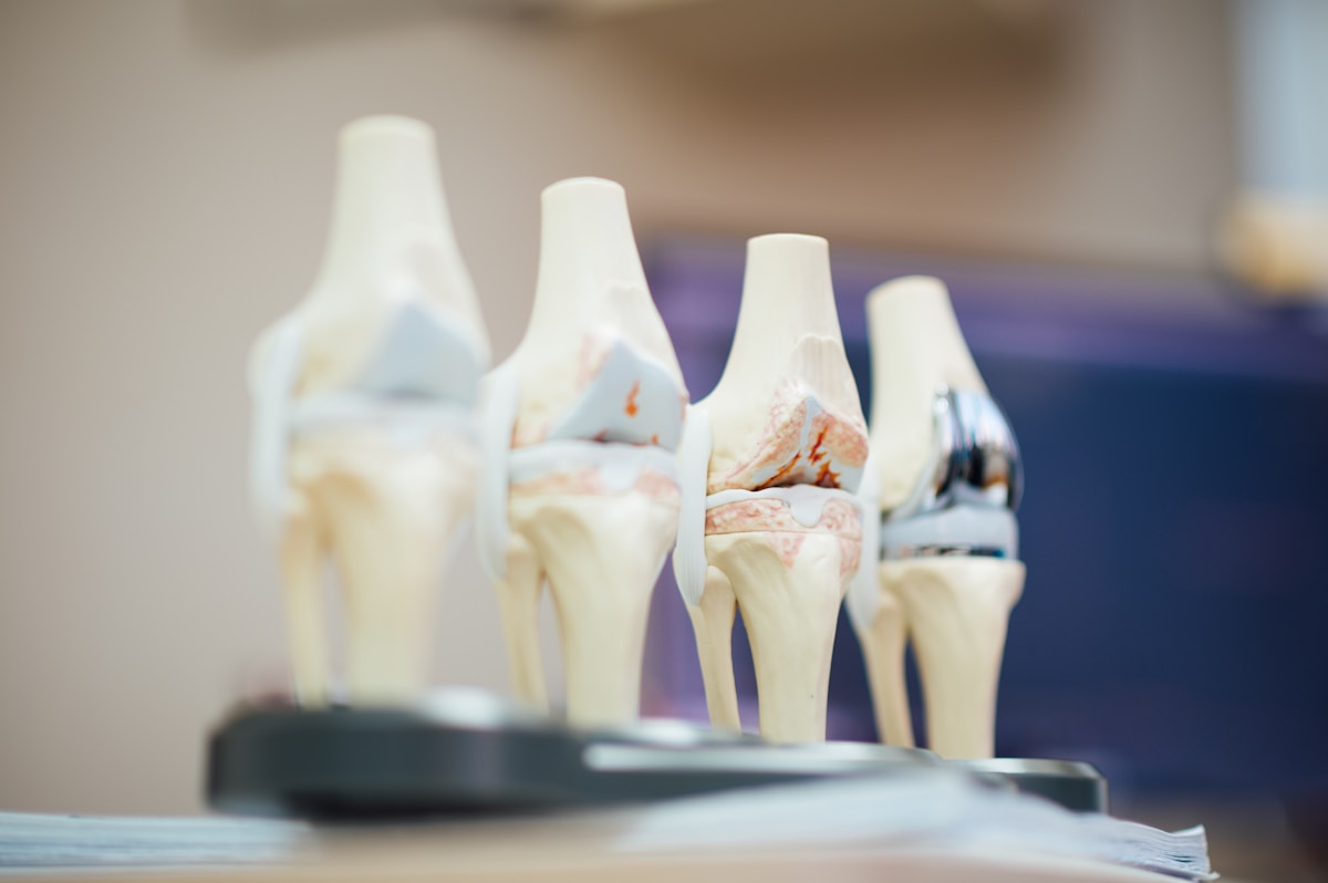Stanford researchers unlock potential to regrow knee cartilage by targeting a single protein
