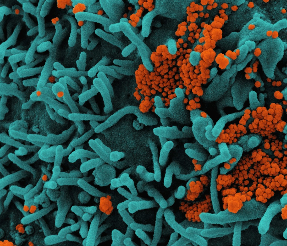 Clever Molecular Partner Revives Vital Antibiotic to Defeat Drug-Resistant Superbugs
