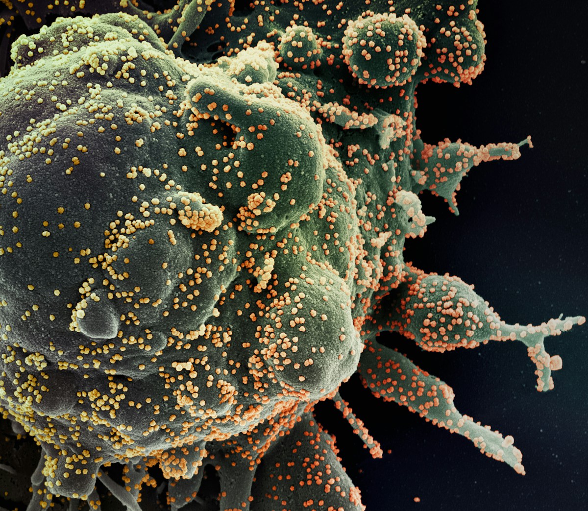 New Molecular Map Marks a Major Breakthrough in the Fight Against Flu Viruses