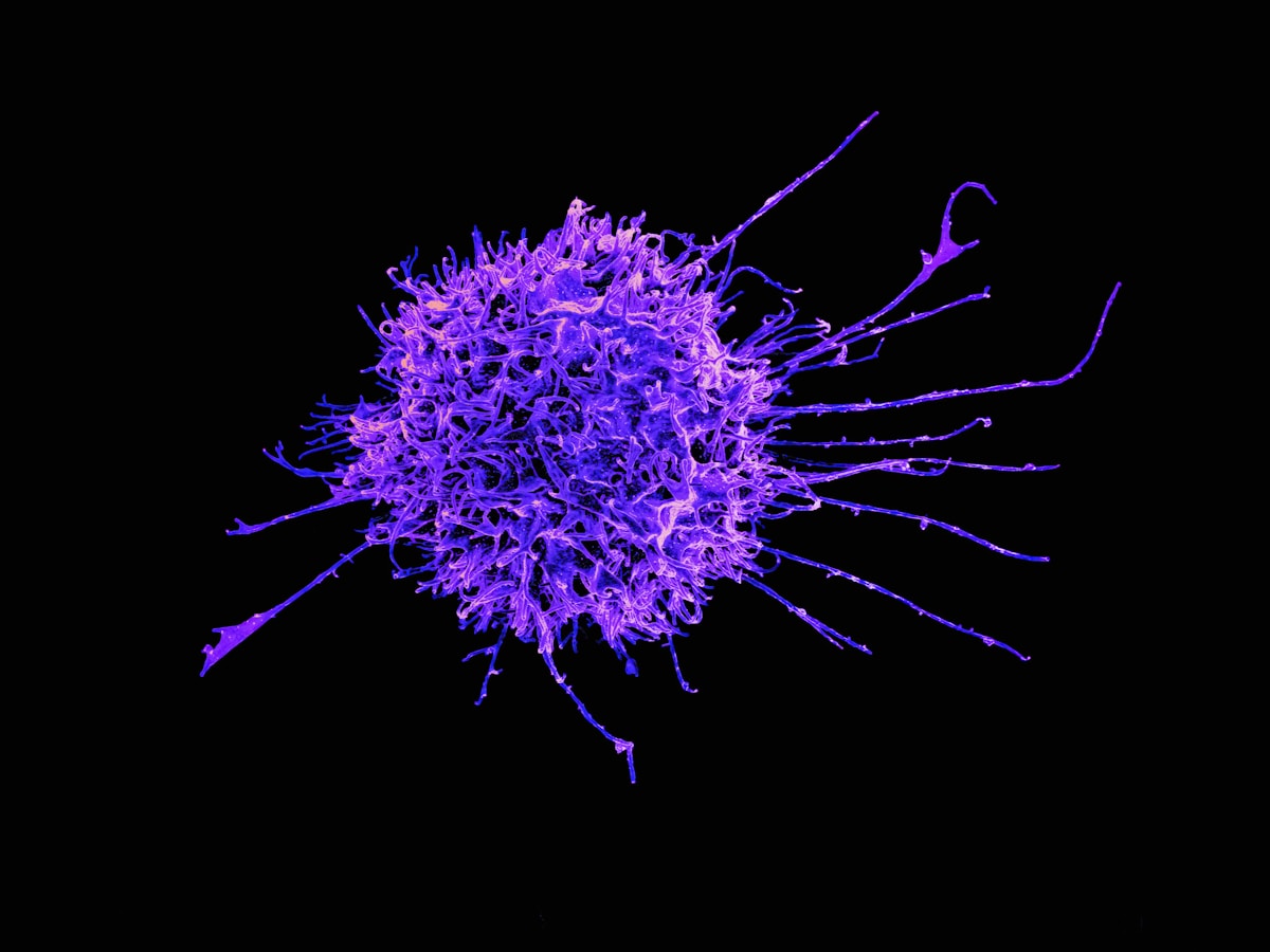 Stanford researchers discover microscopic 'exploding' immune cells that could inspire new ways to fight cancer