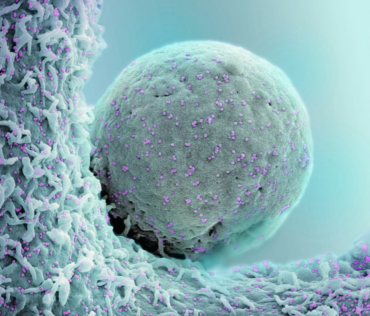 Innovative Bioengineered Chewing Gum Shows Remarkable Success in Reducing Oral Cancer-Linked Viruses and Bacteria