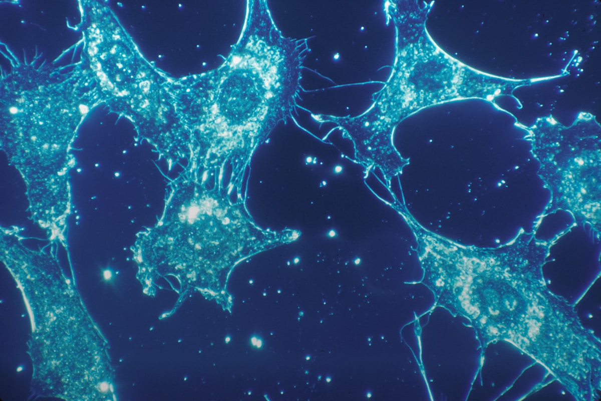 Innovative Nanoparticles Help Surgeons Spot and Destroy Hidden Brain Cancer Cells
