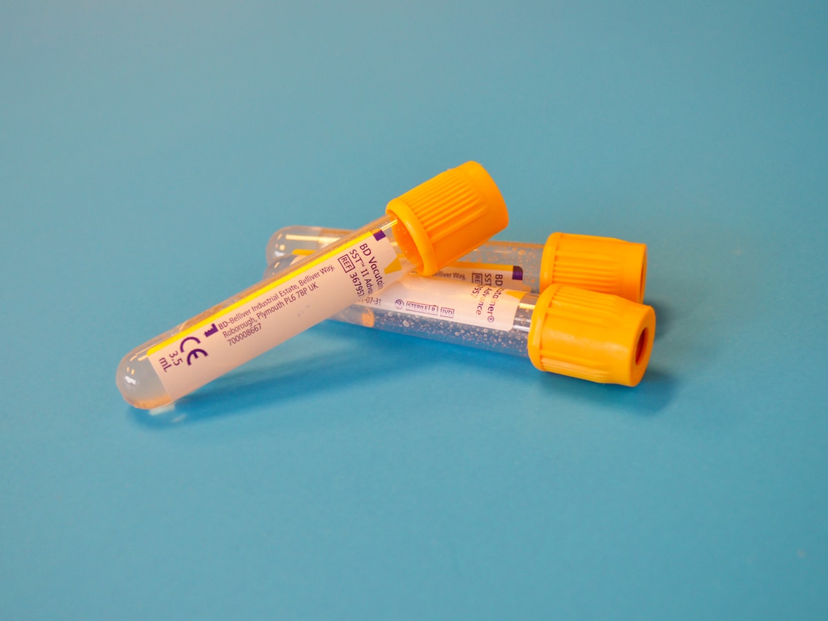 Simple At-Home Urine Test Accurately Detects Bladder Cancer in NHS Trial
