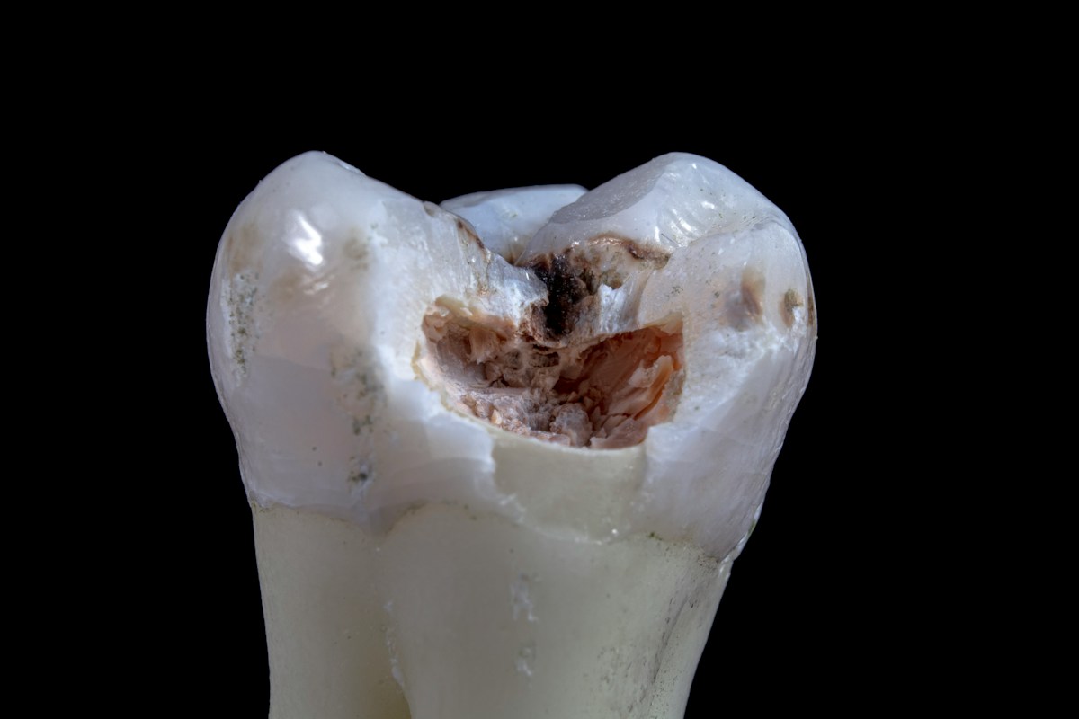 Ancient Teeth Unlocks a Deep Connection in the Human Family Tree