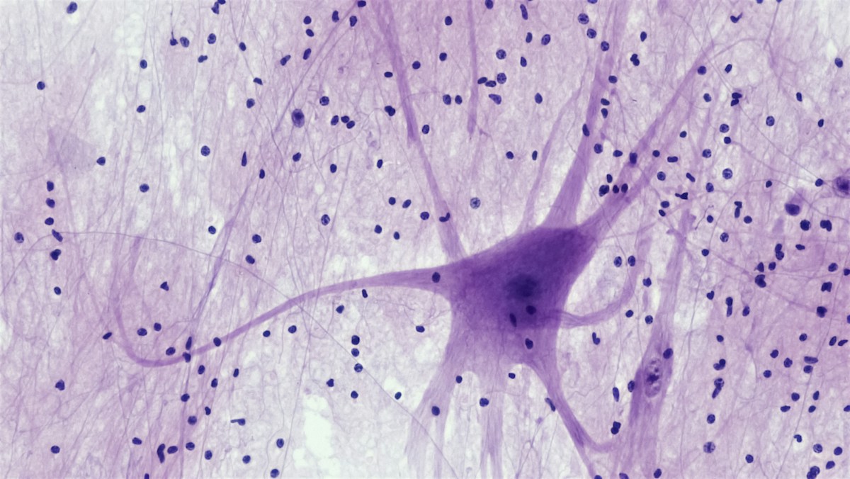 A Beautiful Discovery Inside Our Brains: Cells Resemble Tiny Pearls, Transforming Our Understanding of How We Think