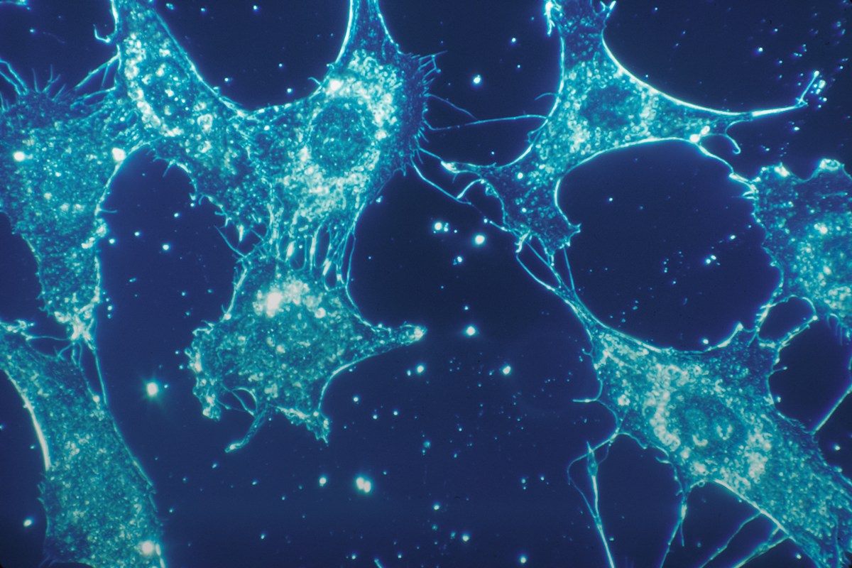 Stem Cell Breakthrough Offers Hope for Reversing Stroke Damage