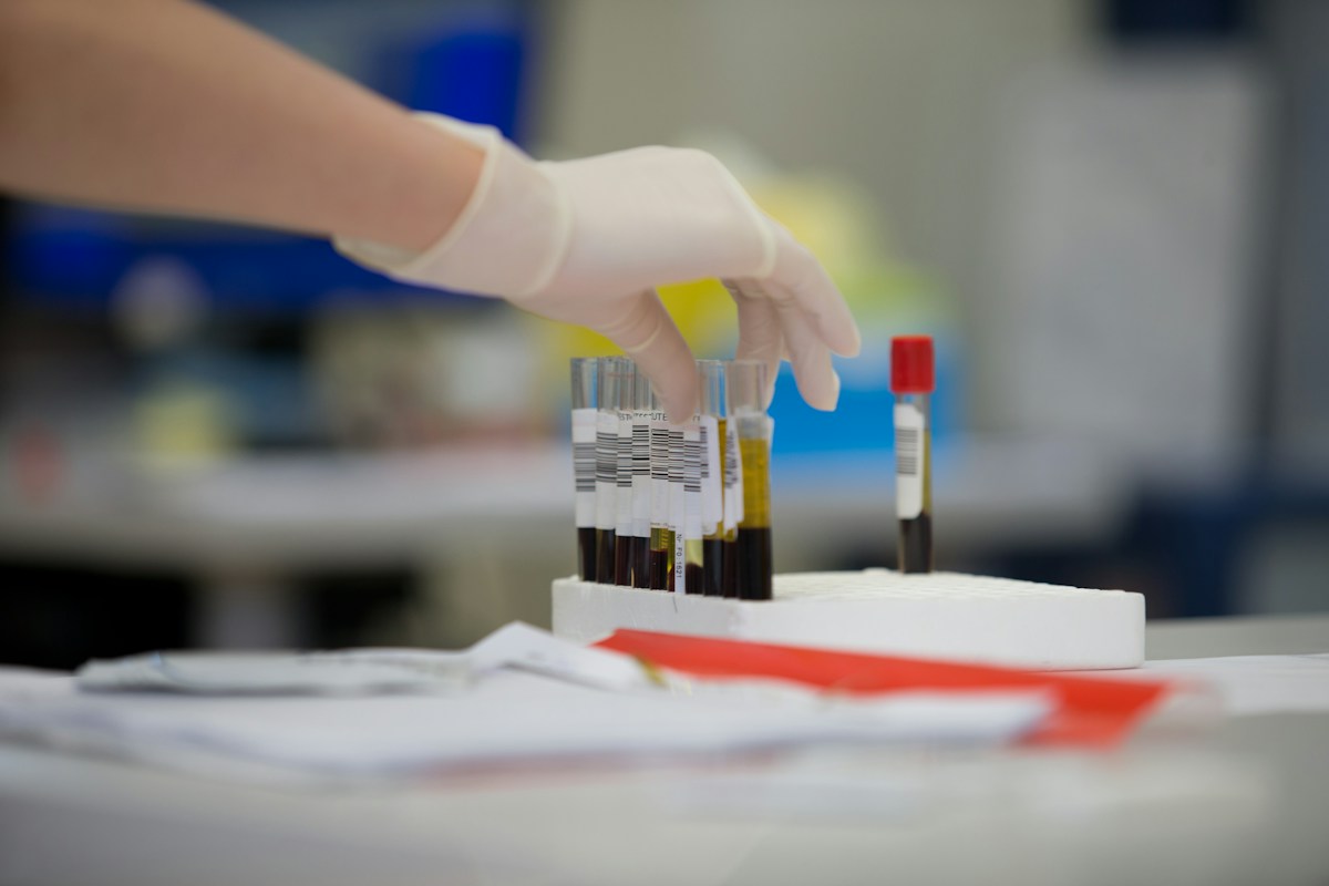 Innovative Urine Test Offers Pain-Free Alternative for Womb Cancer Detection