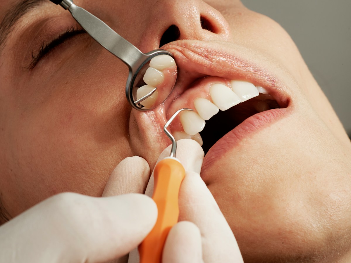 Innovative dental research finds way to target gum disease while protecting your mouth's healthy bacteria
