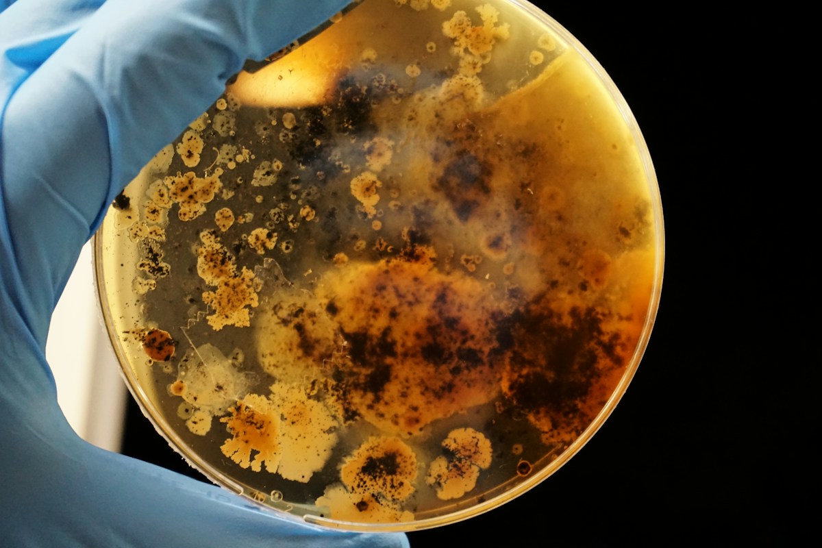 Newly Discovered Enzyme Helps Soil Bacteria Consume Biodegradable Plastics Within a Year