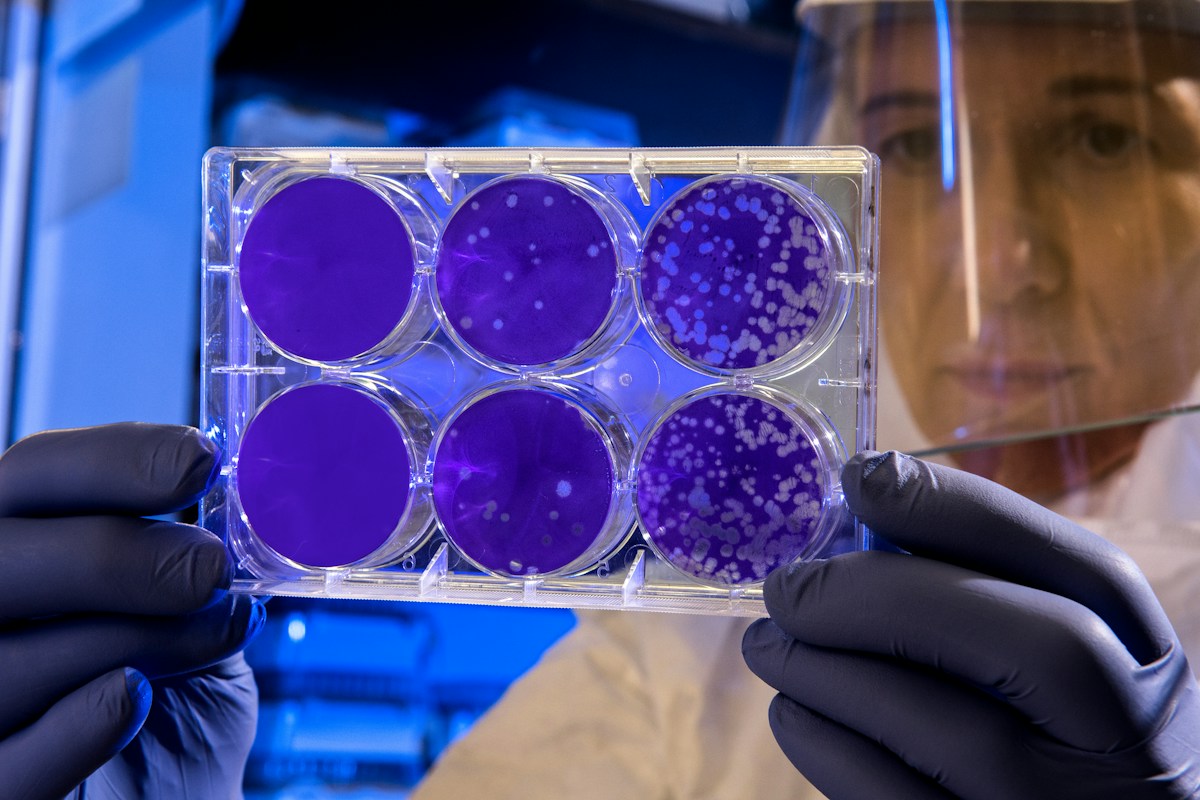 USC Researchers Develop Renewable System for Cancer-Fighting Immune Cells
