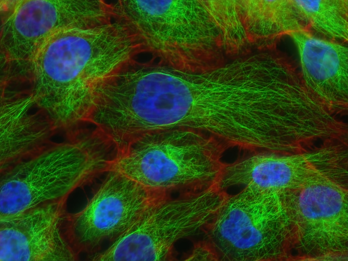 Watch How Your Body's Tiny Warrior Cells Destroy Cancer!