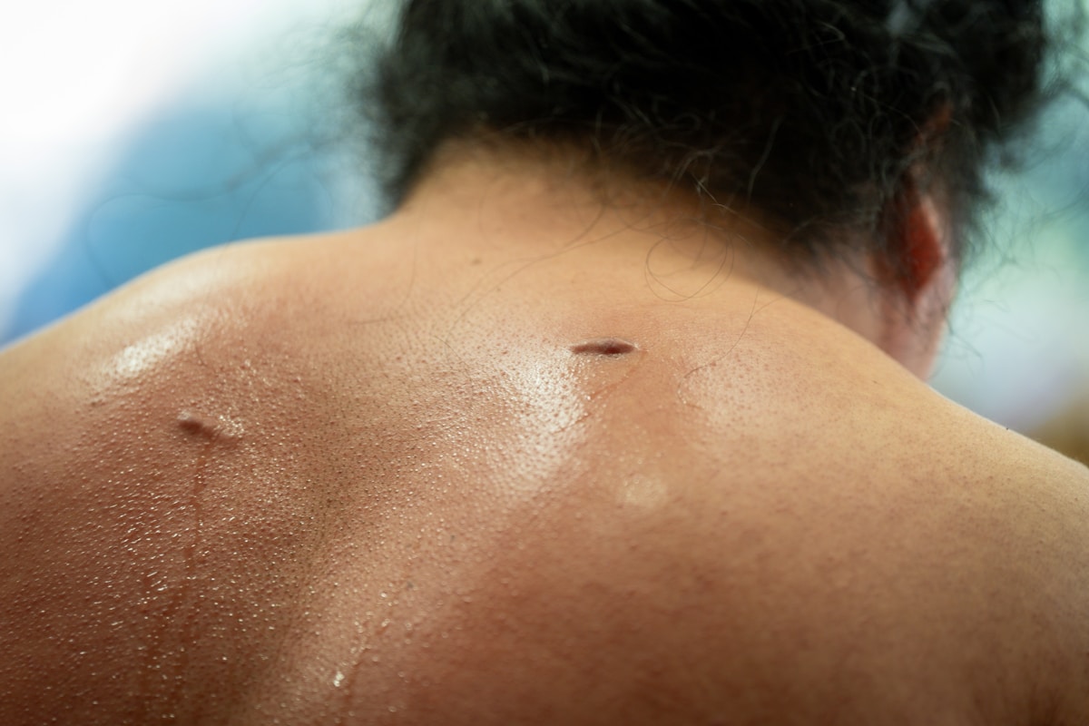Mosquitoes Can Learn to Love the Smells That Are Supposed to Scare Them Away!