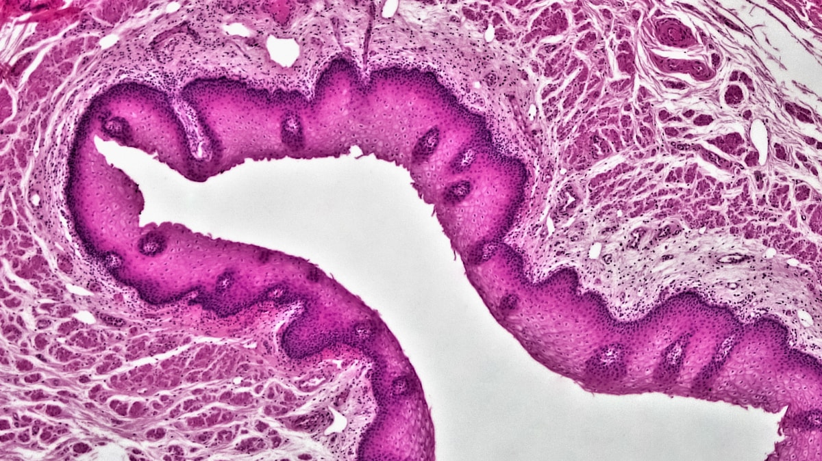 Our Eyes Might Have Come from a Tiny One-Eyed Sea Worm!