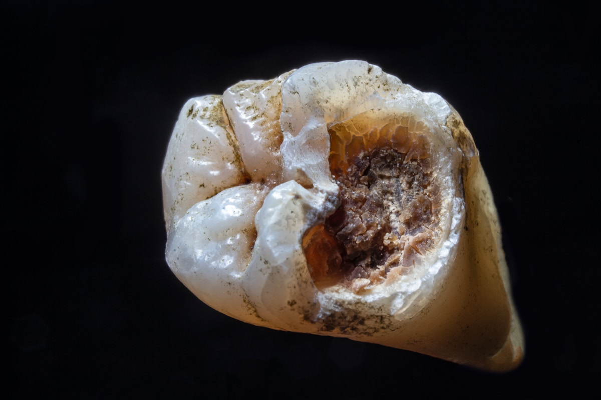 Why You Might Dislike Eating Bugs! Your Teeth Hold a 9,000-Year-Old Secret